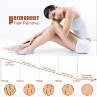 IPL Hair Removal Device — At-Home, 999,999 Flashes